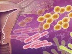 Infecciones vaginales: una preocupación en la salud femenina en México