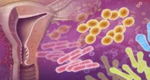 Infecciones vaginales: una preocupación en la salud femenina en México
