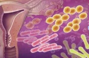 Infecciones vaginales: una preocupación en la salud femenina en México